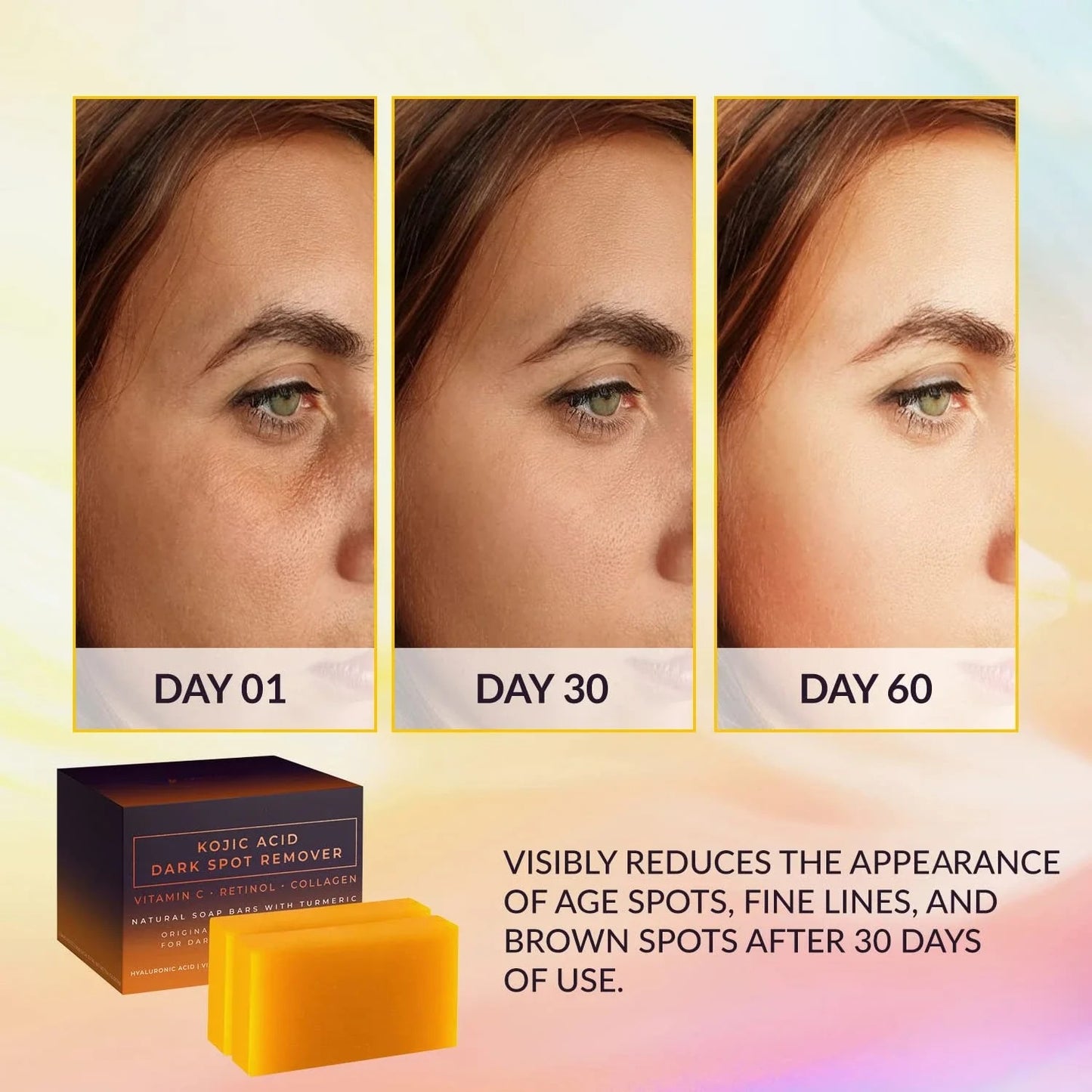 Dark Spot Remover Soap – Brightening & Whitening Bar with Vitamin C, Retinol & Collagen