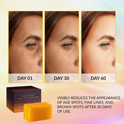 Dark Spot Remover Soap – Brightening & Whitening Bar with Vitamin C, Retinol & Collagen